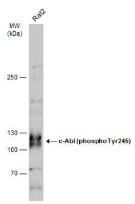 Western Blot: c-Abl [p Tyr245] Antibody [NBP3-13326]